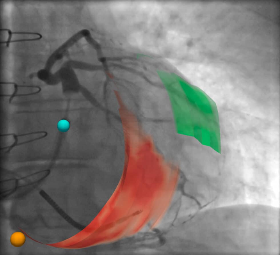 AP-view-scar-and-latest-activation